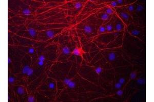Immunostaining of cultured rat neurons and glia showing labeling of NF-M in red.