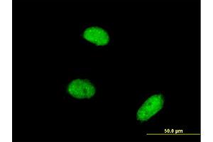 Immunofluorescence of monoclonal antibody to AKIRIN2 on HeLa cell. (AKIRIN2 anticorps  (AA 1-203))