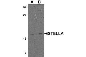 Image no. 1 for anti-Developmental Pluripotency Associated 3 (DPPA3) (C-Term) antibody (ABIN342700)