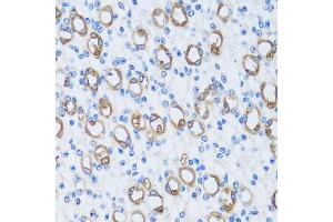 Immunohistochemistry of paraffin-embedded mouse kidney using C antibody (ABIN7266074) at dilution of 1:100 (40x lens).