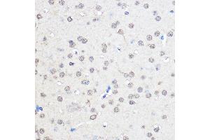 Immunohistochemistry of paraffin-embedded Mouse brain using CNOT7 Rabbit pAb (ABIN6127563, ABIN6138783, ABIN6138784 and ABIN6224834) at dilution of 1:50 (40x lens). (CNOT7 anticorps  (AA 90-160))