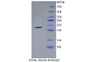 SDS-PAGE (SDS) image for Matrix Metallopeptidase 9 (Gelatinase B, 92kDa Gelatinase, 92kDa Type IV Collagenase) (MMP9) (AA 226-391) protein (His tag) (ABIN1980763) (MMP 9 Protein (AA 226-391) (His tag))