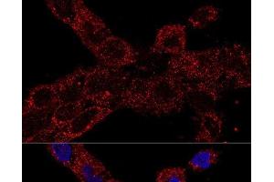 Confocal immunofluorescence analysis of A-431 cells using RPL21 Polyclonal Antibody at dilution of 1:100. (RPL21 anticorps)