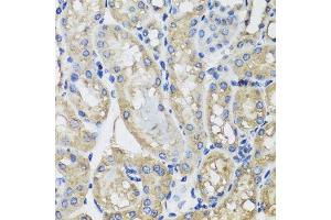 Immunohistochemistry of paraffin-embedded mouse kidney using MRPS22 antibody.