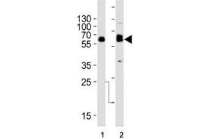 Western blot analysis of lysate from (1) SW480 and (2) U-87 MG cell line using TH antibody at 1:1000. (Tyrosine Hydroxylase anticorps  (AA 486-514))
