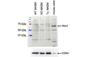 ABIN2564188 (1µg/ml) staining of MASM lysate (35µg protein in RIPA buffer). (NOX1 anticorps  (Internal Region))