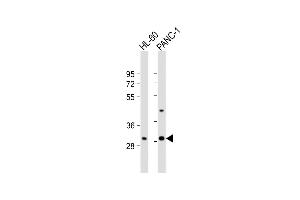 All lanes : Anti-RGR Antibody (Center) at 1:1000 dilution Lane 1: HL-60 whole cell lysate Lane 2: NC-1 whole cell lysate Lysates/proteins at 20 μg per lane. (RGR anticorps  (AA 265-291))