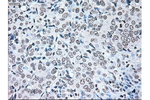 Image no. 9 for anti-B-Raf proto-oncogene, serine/threonine kinase (BRAF) antibody (ABIN1496961)