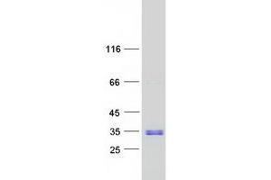 Validation with Western Blot