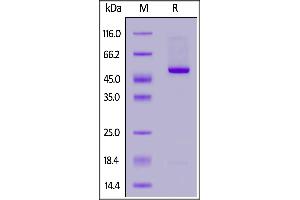 Biotinylated Human IL-21, Fc,Avitag on  under reducing (R) condition. (IL-21 Protein (AA 30-162) (Fc Tag,AVI tag,Biotin))