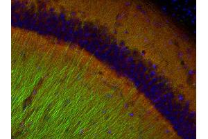 Immunohistochemistry (IHC) image for anti-Catenin, beta (CATNB) (AA 768-782) antibody (ABIN1742544)