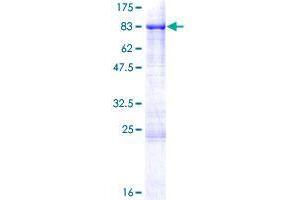 Image no. 1 for SHC (Src Homology 2 Domain Containing) Transforming Protein 3 (SHC3) (AA 1-594) protein (GST tag) (ABIN1319937)