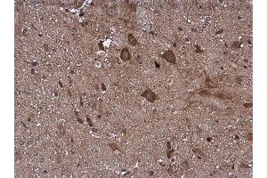 IHC-P Image Pyruvate Dehydrogenase E1 beta subunit antibody detects Pyruvate Dehydrogenase E1 beta subunit protein at cytoplasm in mouse brain by immunohistochemical analysis. (PDHE1-B anticorps)