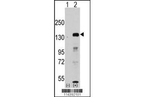 Western blot analysis of JHDM1a/FBXL11 using rabbit polyclonal JHDM1a/FBXL11 Antibody. (KDM2A anticorps  (AA 500-527))