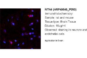 Image no. 2 for anti-Netrin 4 (NTN4) (N-Term) antibody (ABIN2783832) (Netrin 4 anticorps  (N-Term))