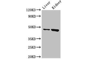 Western Blot Positive WB detected in: Mouse liver tissue, Mouse kidney tissue All lanes: WDFY1 antibody at 3 μg/mL Secondary Goat polyclonal to rabbit IgG at 1/50000 dilution Predicted band size: 47 kDa Observed band size: 47 kDa (WDFY1 anticorps  (AA 261-357))
