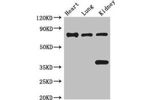 Western Blot Positive WB detected in: Mouse heart tissue, Mouse lung tissue, Mouse kidney tissue All lanes: BRSK1 antibody at 3. (BRSK1 anticorps  (AA 426-591))