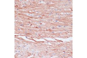Immunohistochemistry of paraffin-embedded mouse heart using VASP antibody (ABIN6134453, ABIN6150064, ABIN6150065 and ABIN6218508) at dilution of 1:100 (40x lens).