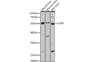 Western blot analysis of extracts of various cell lines, using CNR1 antibody (ABIN1679303, ABIN3015494, ABIN3015496 and ABIN6218536) at 1:1000 dilution. (CNR1 anticorps  (AA 1-120))