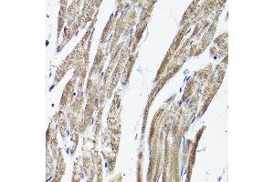 Immunohistochemistry of paraffin-embedded rat heart using R Rabbit pAb (ABIN3017320, ABIN3017321, ABIN3017322 and ABIN6220039) at dilution of 1:200 (40x lens). (RAMP2 anticorps  (AA 1-145))