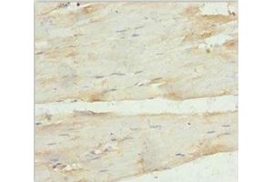 anti-Ankyrin Repeat Domain 1 (Cardiac Muscle) (ANKRD1) (AA 1-130) antibody