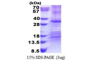 SDS-PAGE (SDS) image for Coiled-Coil-Helix-Coiled-Coil-Helix Domain Containing 3 (CHCHD3) (AA 1-227) protein (His tag) (ABIN6387316)