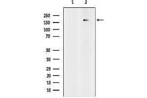 anti-Remodeling and Spacing Factor 1 (RSF1) (Internal Region) antibody