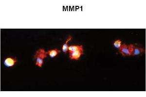 Sample Type:  Human Macrophange Cells  Green:  primary  Red:  phallodin  Blue:  DAPI  Yellow:  green/red  Primary   Dilution:   1:200  Secondary Antibody:  anti-Rabbit IgG-FITC  Secondary   Dilution:   1:1000  Image Submitted By:  Milan Fiala University of California, Los Angeles 
