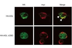 Expression of myc-GS causes wild type but not the ACBD mutant of AGL to aggregate around the S-stain-positive inclusions.