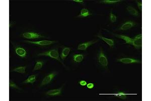 Immunofluorescence of purified MaxPab antibody to EPHX1 on HeLa cell. (EPHX1 anticorps  (AA 1-455))