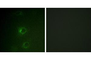 Peptide - +Immunofluorescence analysis of COS7 cells, using CBL (Ab-700) antibody. (CBL anticorps  (Tyr700))