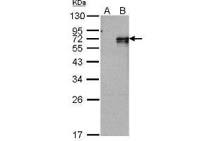 WB Image Western Blot analysis of NR4A1 expression in transfected 293T cell line by NR4A1 polyclonal antibody. (NR4A1 anticorps  (C-Term))