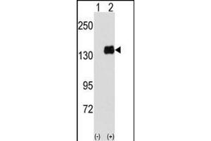 Western blot analysis of PUM1 (arrow) using PUM1 Antibody (Y83) (ABIN391822 and ABIN2841668). (PUM1 anticorps  (AA 62-91))