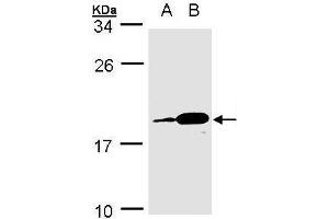 WB Image Sample(30 ug whole cell lysate) A:MOLT4 , B:Raji , 15% SDS PAGE antibody diluted at 1:1000 (MZB1 anticorps)