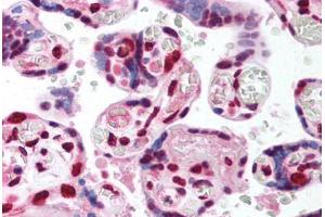Human Placenta (formalin-fixed, paraffin-embedded) stained with TCF4 antibody ABIN214151 at 5 ug/ml followed by biotinylated goat anti-rabbit IgG secondary antibody ABIN481713, alkaline phosphatase-streptavidin and chromogen.