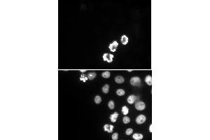 Histone H3S10ph antibody (mAb) (Clone 6G8B7) tested by immunofluorescence. (Histone 3 anticorps  (pSer10))