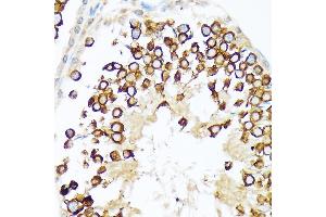 Immunohistochemistry of paraffin-embedded rat testis using Calmegin Rabbit mAb (ABIN7266026) at dilution of 1:100 (40x lens).