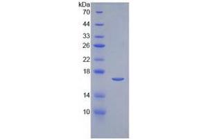 SDS-PAGE of Protein Standard from the Kit (Highly purified E. (IL-2 Kit CLIA)