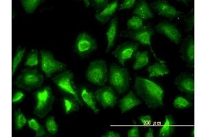 Immunofluorescence of monoclonal antibody to PGM1 on HeLa cell. (Phosphoglucomutase 1 anticorps  (AA 1-562))