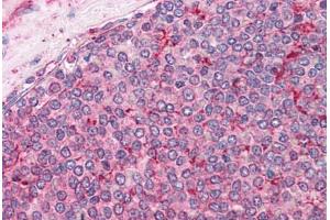 Human Spleen: Formalin-Fixed, Paraffin-Embedded (FFPE) (Calnexin anticorps  (AA 109-274))