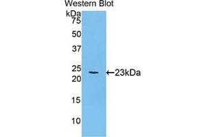 Western blot analysis of the recombinant protein. (Acetylcholinesterase anticorps  (AA 366-554))