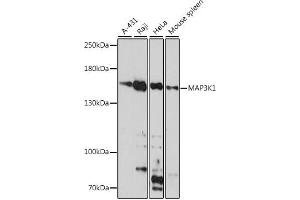 Western blot analysis of extracts of various cell lines, using MK1 antibody (ABIN7268647) at 1:1000 dilution.