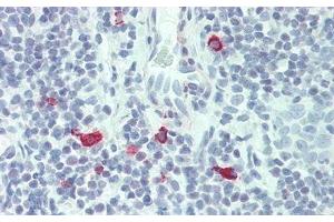 Detection of IL3 in Human Tonsil Tissue using Polyclonal Antibody to Interleukin 3 (IL3) (IL-3 anticorps  (AA 20-152))