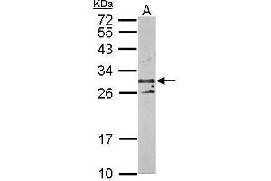 WB Image Sample (50 ug of whole cell lysate) A: mouse kidney 12% SDS PAGE antibody diluted at 1:1000