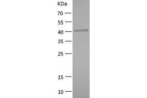 Western Blotting (WB) image for RNA Binding Motif Protein 17 (RBM17) (AA 1-401) protein (His-IF2DI Tag) (ABIN7124921)