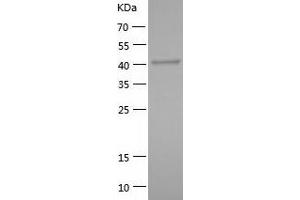 Western Blotting (WB) image for RNA Binding Motif Protein 17 (RBM17) (AA 1-401) protein (His tag) (ABIN7124921)