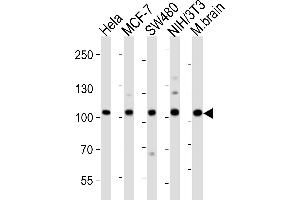 Western blot analysis of lysates from Hela, MCF-7, S, mouse NIH/3T3 cell line, mouse brain tissue lysate (from left to right), using EPHA4 Antibody (Center) (ABIN6243785 and ABIN6577670). (EPH Receptor A4 anticorps  (AA 383-417))
