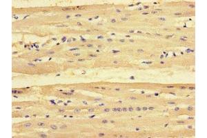 Immunohistochemistry of paraffin-embedded human heart tissue using ABIN7163088 at dilution of 1:100 (NOXA anticorps  (AA 1-136))