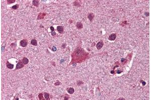 Human Brain, Cortex: Formalin-Fixed, Paraffin-Embedded (FFPE)