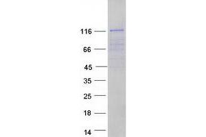 Validation with Western Blot